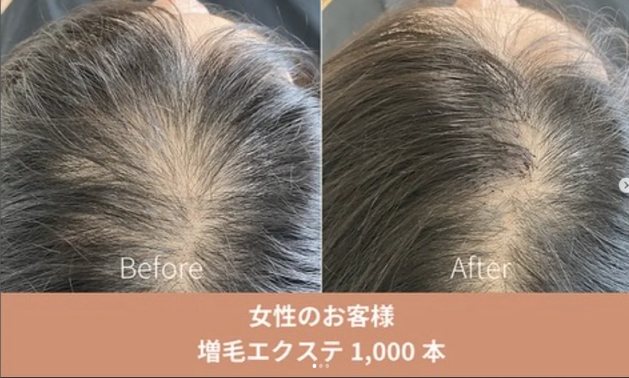 初回限定増毛エクステ1,000本＋カウンセリング 12480円→500円